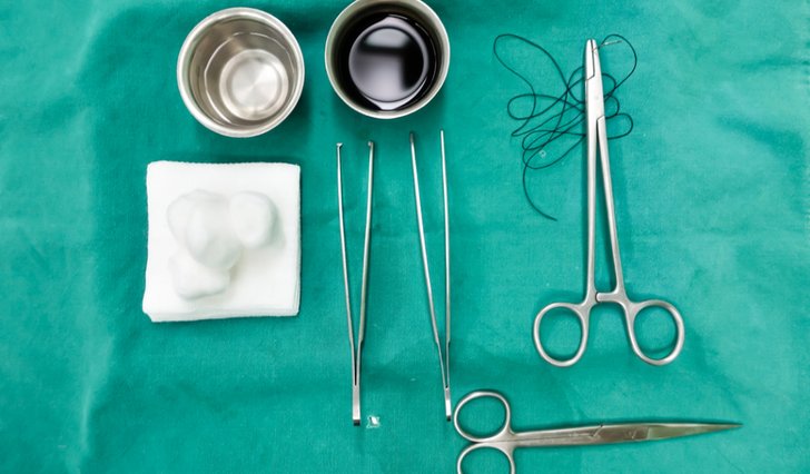 10 Things That May Happen While Removing Surgical Staples Without Tool